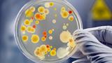 Gloved hand holding a bacteria culture on an agar plate, photo by AndreasReh/Getty Images