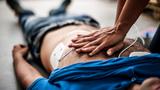 Closeup of a person performing CPR on a man, photo by Pixel_away/Getty Images
