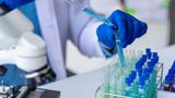 Gloved hand holding a test tube and a dropper with liquid, photo by ArLawKa AungTun/Getty Images