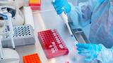 A laboratory technician is conducting a test, photo by Evgeniy_Salov/Adobe Stock